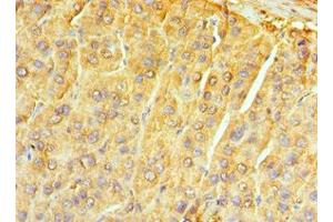 Immunohistochemistry (IHC) image for anti-Neurotrophic tyrosine Kinase, Receptor, Type 3 (NTRK3) (AA 40-300) antibody (ABIN7161741)