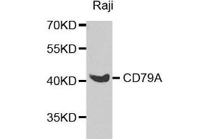 Western blot analysis of extracts of various cell lines, using CD79A antibody. (CD79a 抗体  (AA 33-145))