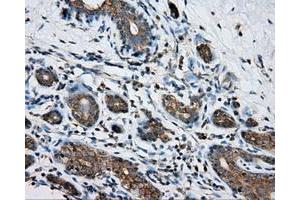 Immunohistochemical staining of paraffin-embedded breast tissue using anti-PRKAR2A mouse monoclonal antibody. (PRKAR2A 抗体)