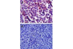 Image no. 2 for anti-Toll-Like Receptor 4 (TLR4) (AA 420-435) antibody (ABIN361724) (TLR4 抗体  (AA 420-435))