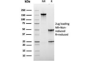 SDS-PAGE Analysis Purified Monospecific Mouse Monoclonal Antibody to LAG-3 (LAG3/3261). (LAG3 抗体)