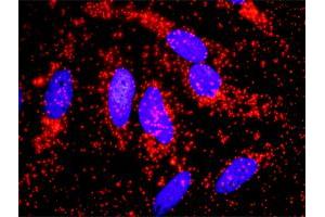 Proximity Ligation Analysis of protein-protein interactions between ACTN4 and CTNNB1. (alpha Actinin 4 抗体  (AA 1-911))