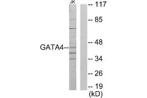 Western blot analysis of extracts from Jurkat cells, using GATA4 antibody. (GATA4 抗体  (Internal Region))