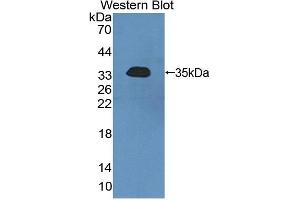 Western blot analysis of the recombinant protein. (SGK2 抗体  (AA 40-311))