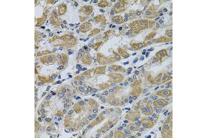 Immunohistochemistry of paraffin-embedded human stomach using PTK7 antibody. (PTK7 抗体)