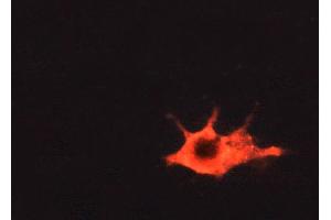 immunofluorescence analysis of A549 cells, using 1/500-1/1000 (BMX 抗体  (C-Term))