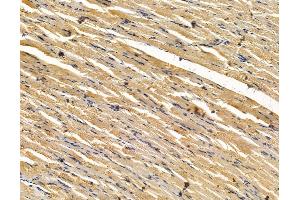 ABIN7096107 and ABIN7100169 at 1/100 staining rat muscle tissue by IHC-P. (EPS8-Like 1 抗体)