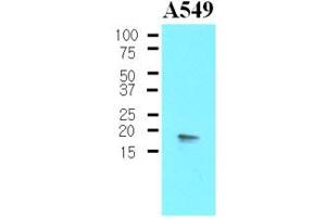 Western blot analysis: The Cell lysates of A549 (30ug) were resolved by SDS-PAGE, transferred to NC membrane and probed with anti-human PPP1R14A (1:500). (CPI-17 抗体)