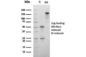 SDS-PAGE Analysis Purified C1QA Mouse Monoclonal Antibody (C1QA/2956). (C1QA 抗体  (AA 104-237))