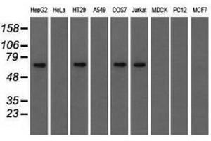 Image no. 4 for anti-Insulin-Like Growth Factor 2 mRNA Binding Protein 2 (IGF2BP2) antibody (ABIN1498821)