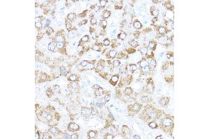 Immunohistochemistry of paraffin-embedded human liver using Kaiso/Kaiso/ZBTB33 Rabbit pAb  at dilution of 1:350 (40x lens). (ZBTB33 抗体  (AA 523-672))