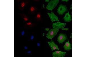 Phospho-EZH2 (Thr416) Antibody staining A549 cells(4h of LPS treatment) by IF/ICC.