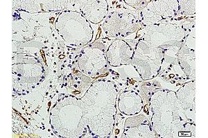 Formalin-fixed and paraffin embedded human colon tissue labeled with Anti Prominin2 Polyclonal Antibody, unconjugated (ABIN715151) at 1:200 followed by incubation with conjugated secondary antibody and DAB staining