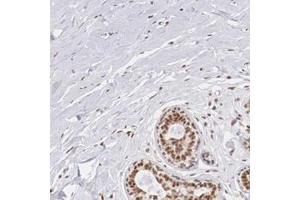 Immunohistochemical staining of human breast with ZNF275 polyclonal antibody  shows strong nuclear positivity in glandular cells. (ZNF275 抗体)