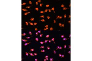 Immunofluorescence (IF) image for anti-Protein Kinase C, beta (PRKCB) (AA 220-340) antibody (ABIN6146200)