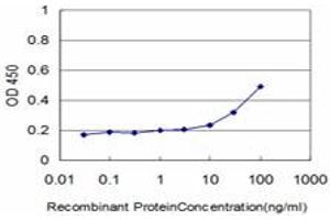 Detection limit for recombinant GST tagged DLD is approximately 1ng/ml as a capture antibody. (DLD 抗体  (AA 1-509))