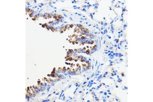Immunohistochemistry of paraffin-embedded mouse lung using TMED3 antibody (ABIN7270944) at dilution of 1:100 (40x lens). (TMED3 抗体  (AA 24-180))