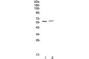 Western blot testing of human 1) HepG2 and 2) PANC-1 cell lysate with STAM1 antibody at 0. (STAM 抗体)