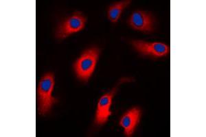 Immunofluorescent analysis of Cytokeratin 18 staining in MCF7 cells. (Cytokeratin 18 抗体  (N-Term))