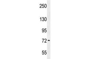 PAK6 antibody western blot analysis in K562 lysate. (PAK6 抗体  (AA 268-297))