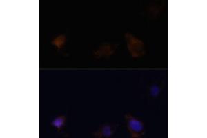Immunofluorescence analysis of C6 cells using Zyxinin antibody (ABIN3023008, ABIN3023009, ABIN3023010 and ABIN6219343) at dilution of 1:100.