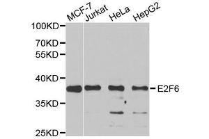 Western blot analysis of extracts of various cell lines, using E2F6 antibody (ABIN5973627) at 1/1000 dilution. (E2F6 抗体)