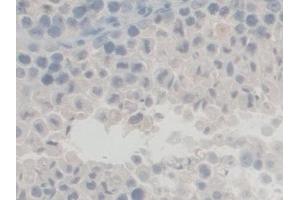 Detection of GFM1 in Mouse Testis Tissue using Polyclonal Antibody to G-Elongation Factor, Mitochondrial 1 (GFM1) (GFM1 抗体  (AA 511-751))