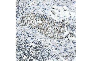 IHC analysis of PRDM5 using anti-PRDM5 antibody (ABIN7600853). (PRDM5 抗体  (AA 24-630))