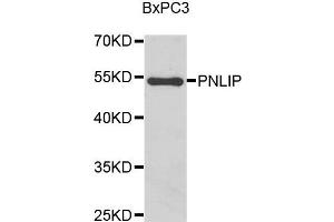 Western blot analysis of BxPC3 cell lysate using PNLIP antibody. (PNLIP 抗体)