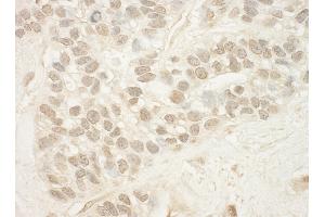 anti-Mediator Complex Subunit 15 (MED15) (AA 450-500) antibody
