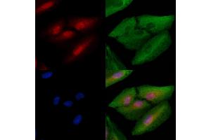 ABIN6261798 and ABIN6278670 staining  cells by IF/ICC. (FOXN1 抗体  (N-Term))
