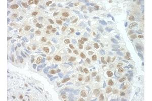 Immunohistochemistry (IHC) image for anti-Pogo Transposable Element with ZNF Domain (POGZ) (AA 1360-1410) antibody (ABIN7454832)