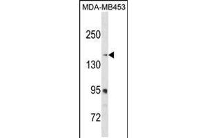 Western blot analysis in MDA-MB453 cell line lysates (35ug/lane). (RRBP1 抗体  (C-Term))
