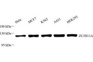 Western blot analysis of ZC3H11A (ABIN7076255) at dilution of 1: 1000 (ZC3H11A 抗体)