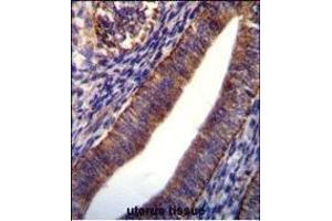 Immunohistochemistry (Paraffin-embedded Sections) (IHC (p)) image for anti-Collagen, Type XXI, alpha 1 (COL21A1) (AA 204-232), (N-Term) antibody (ABIN656084)