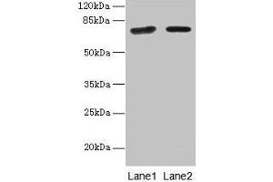 Western blot All lanes: KLHL22 antibody at 8 μg/mL Lane 1: Jurkat whole cell lysate Lane 2: NIH/3T3 whole cell lysate Secondary Goat polyclonal to rabbit IgG at 1/10000 dilution Predicted band size: 72, 56 kDa Observed band size: 72 kDa (KLHL22 抗体  (AA 2-300))