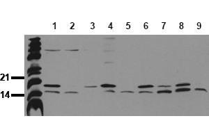 Western Blotting (WB) image for anti-Microtubule-Associated Protein 1 Light Chain 3 beta (MAP1LC3B) (N-Term) antibody (ABIN492615) (LC3B 抗体  (N-Term))