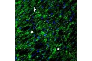 Expression of Glucagon-like peptide 1 receptor in rat hypothalamus - Immunohistochemical staining of rat hypothalamus with Anti-GLP1R (extracellular) Antibody (ABIN7043219, ABIN7044406 and ABIN7044407), (1:200). (GLP1R 抗体  (Extracellular))