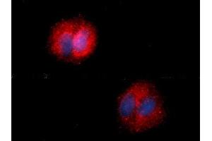 Immunofluorescence (IF) image for anti-Fatty Acid Binding Protein 5 (Psoriasis-Associated) (FABP5) (AA 1-135) antibody (PE) (ABIN5567755) (FABP5 抗体  (AA 1-135) (PE))