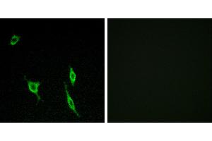 Peptide - +Immunofluorescence analysis of LOVO cells, using DCC antibody.