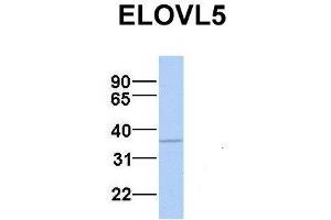 Western Blotting (WB) image for anti-ELOVL Fatty Acid Elongase 5 (ELOVL5) (N-Term) antibody (ABIN2783843)