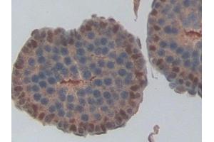 Immunohistochemistry (IHC) image for anti-NME/NM23 Nucleoside Diphosphate Kinase 6 (NME6) (AA 1-173) antibody (ABIN7439435)