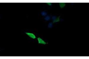 Image no. 5 for anti-Mitogen-Activated Protein Kinase Kinase 3 (MAP2K3) antibody (ABIN1499407)
