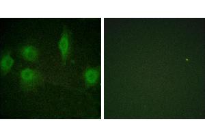 P-peptide - +Immunofluorescence analysis of HuvEc cells, using IL-9R (Phospho-Ser519) antibody. (IL9 Receptor 抗体  (pSer519))