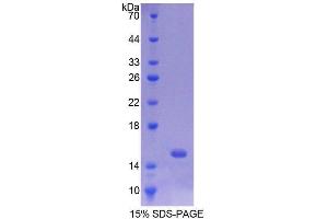 SDS-PAGE analysis of Rat PUMA Protein. (PUMA 蛋白)
