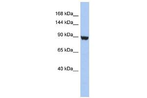 WB Suggested Anti-KCNH6 Antibody Titration:  0. (KCNH6 抗体  (Middle Region))