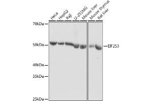 Western blot analysis of extracts of various cell lines, using EIF2S3 antibody (ABIN6130363, ABIN6140051, ABIN6140052 and ABIN6222259) at 1:1000 dilution. (EIF2S3 抗体  (AA 173-472))