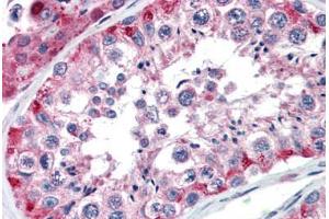 Human Testis (formalin-fixed, paraffin-embedded) stained with NAB1 antibody ABIN462173 followed by biotinylated goat anti-rabbit IgG secondary antibody ABIN481713, alkaline phosphatase-streptavidin and chromogen. (NAB1 抗体  (AA 71-120))