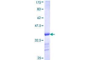 VPS35 Protein (AA 697-796) (GST tag)