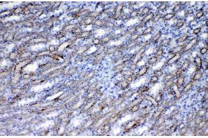 IHC analysis of Flt3 / CD135 using anti-Flt3 / CD135 antibody . (FLT3 抗体  (AA 62-295))
